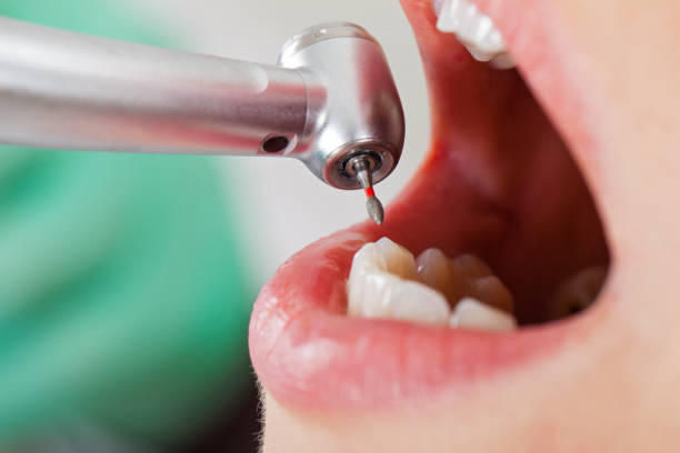 Best Dental Abscess Treatment in Golden Triangle, NJ